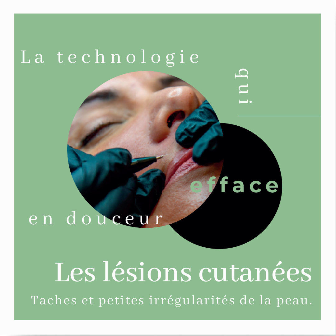 Les lésions cutanées Taches et petites irrégularités de la peau.