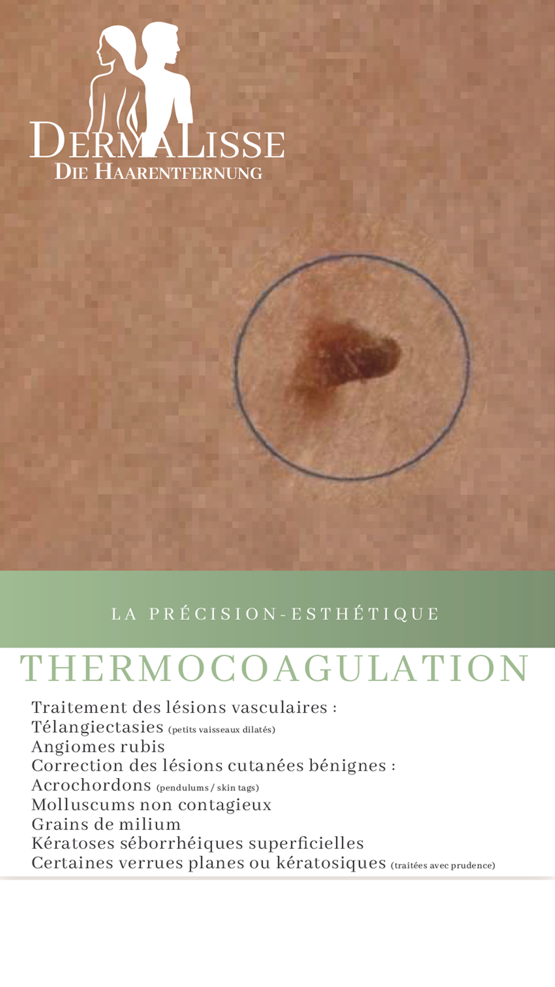 LA PRÉCISION-ESTHÉTIQUE